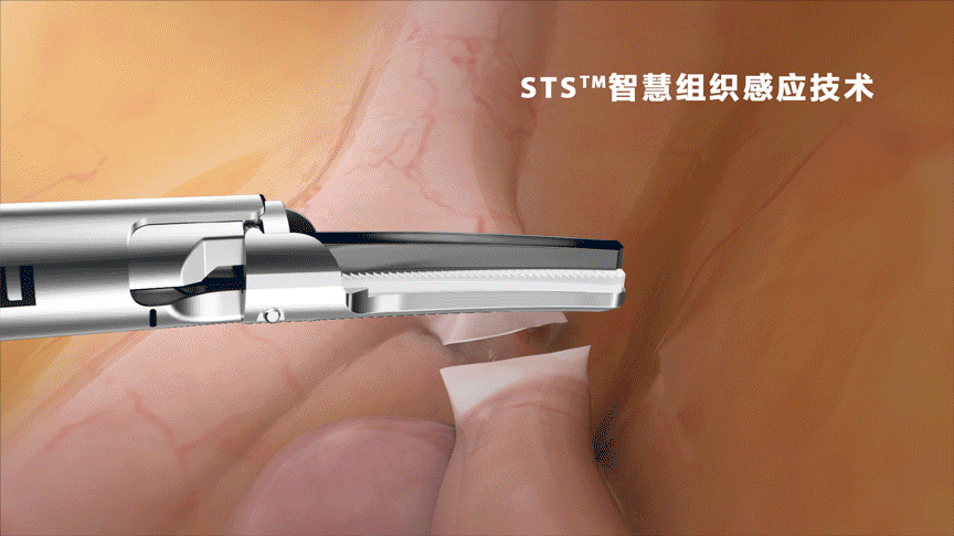 energy-seal-dissect-fig1-1-1