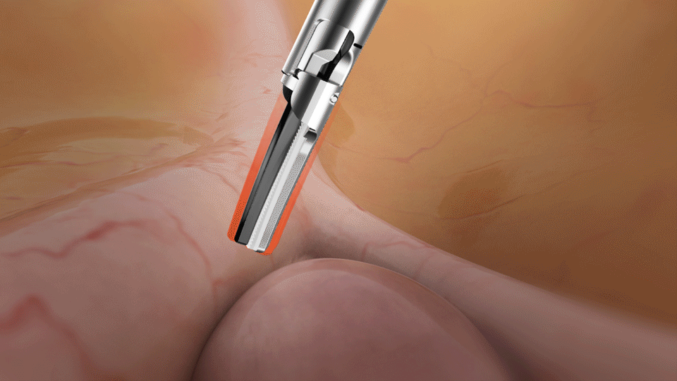 energy-seal-dissect-fig3-1