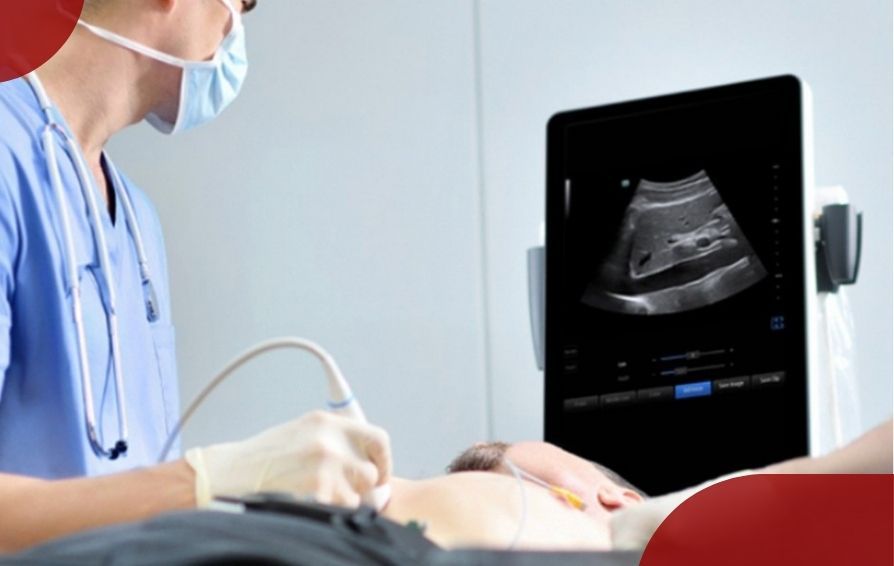 Blog Innovation Card Component PC 894 x 566 - 01-Top-Considerations-When-Buying-an-Ultrasound-Machine-894x566