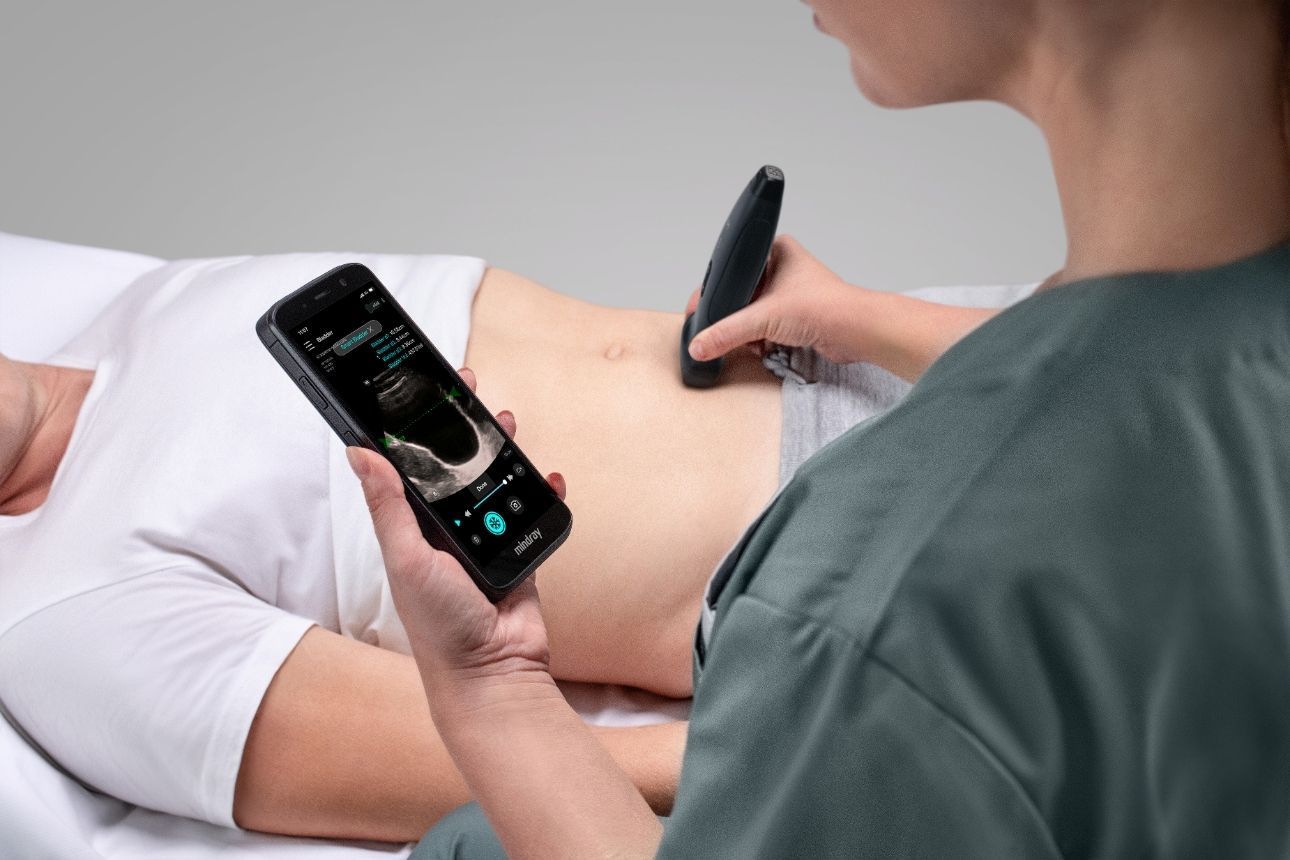 Innovation Image Component 1290x860 - 01-te-air-e5m-wireless-handheld-ultrasound-phone1290x860