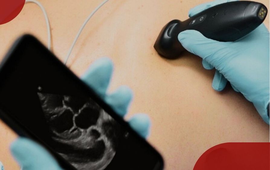 Blog Innovation Card Component PC 894 x 566 - 01-the-role-of-handheld-ultrasound-in-point-of-care-894x566