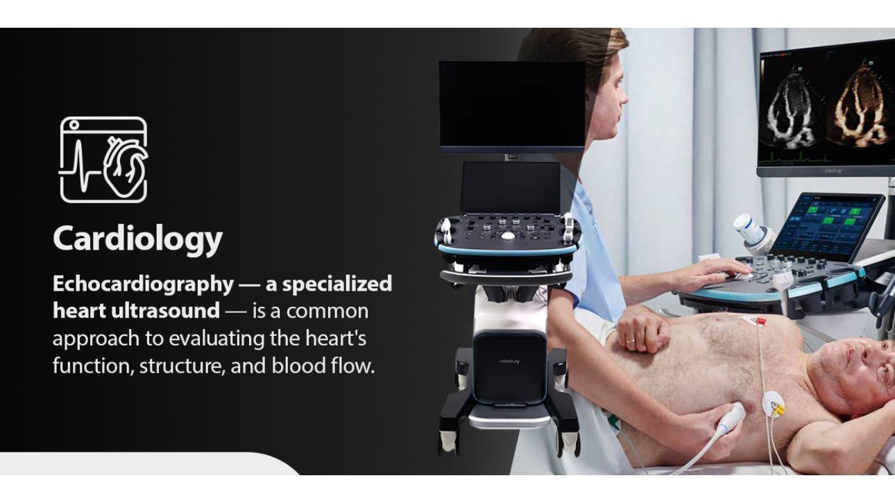 Product Teaser B Swiper Component 1290x725 - 02-Cardiology-1290x725