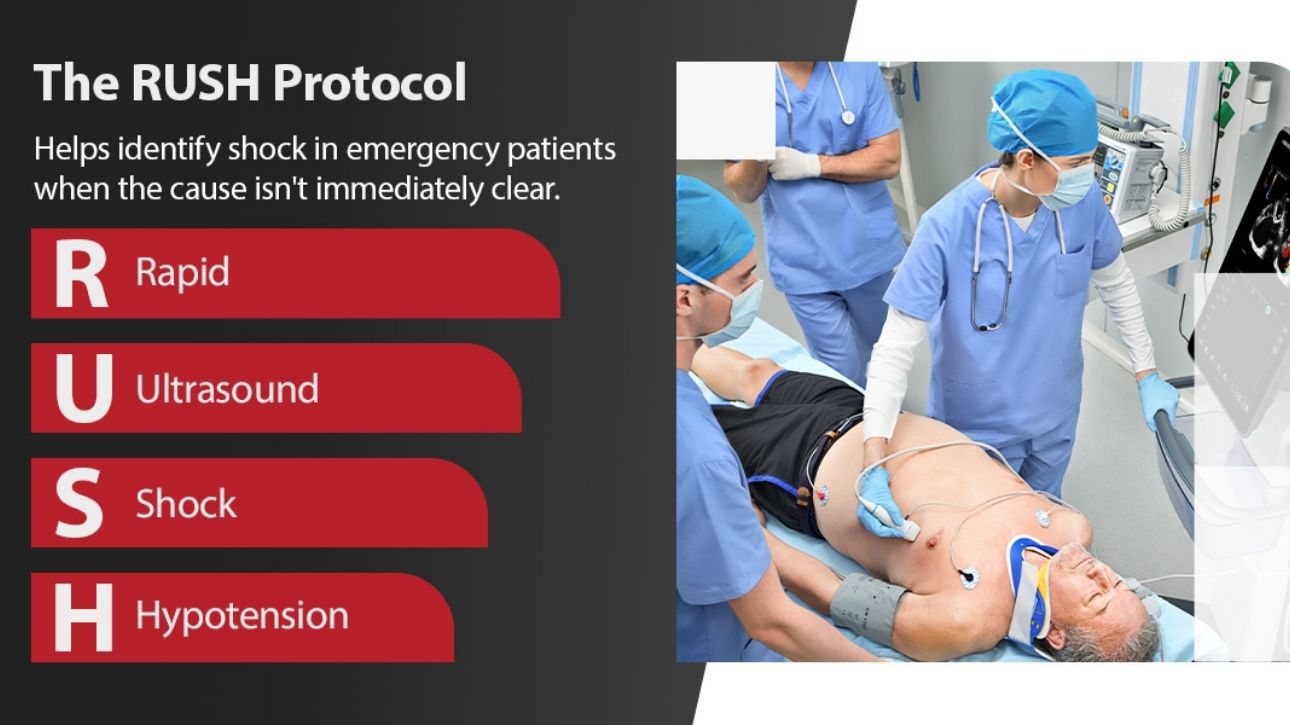 Product Teaser B Swiper Component 1290x725 - 02-The-RUSH-Protocol-R01-1290x725