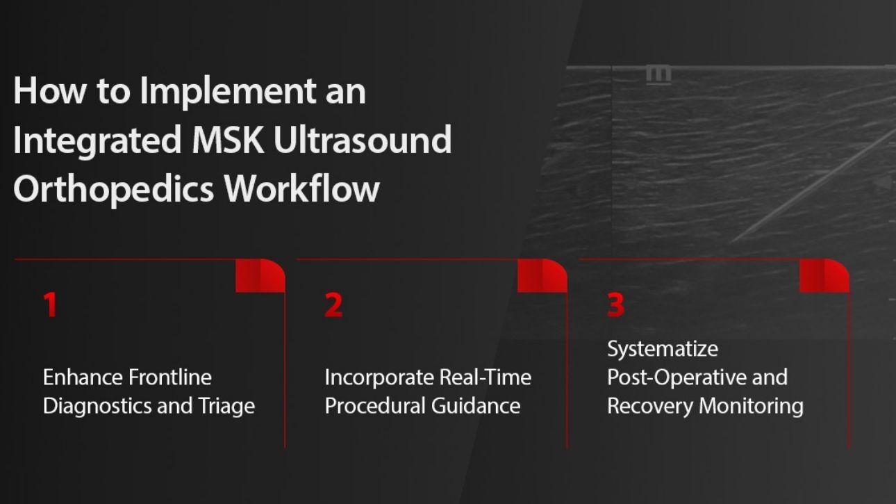 Product Teaser B Swiper Component 1290x725 - 02-how-to-implement-an-integrated-msk-ultrasound-orthopedics-workflow-1290x725