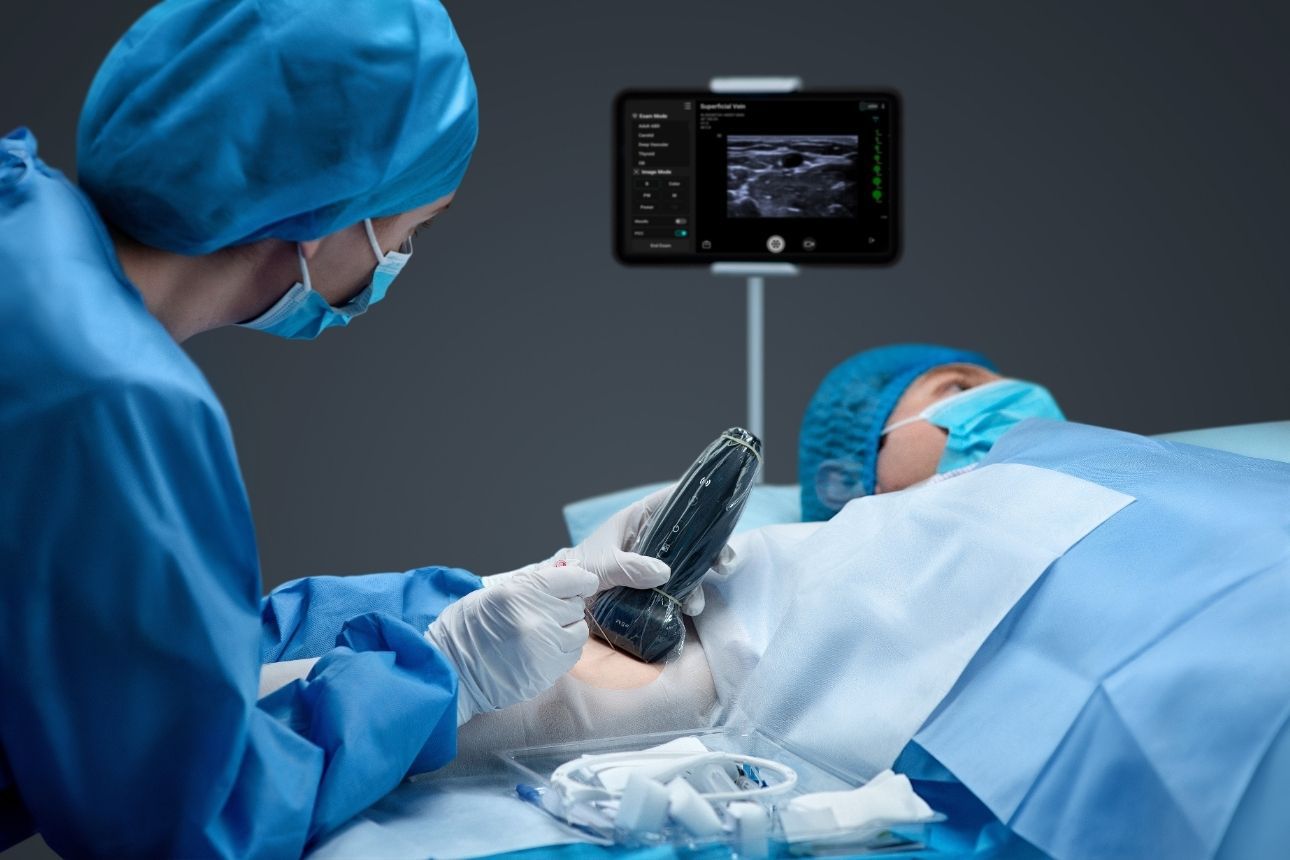 Innovation Image Component 1290x860 - 02-te-air-e5m-wireless-handheld-ultrasound-1290x860