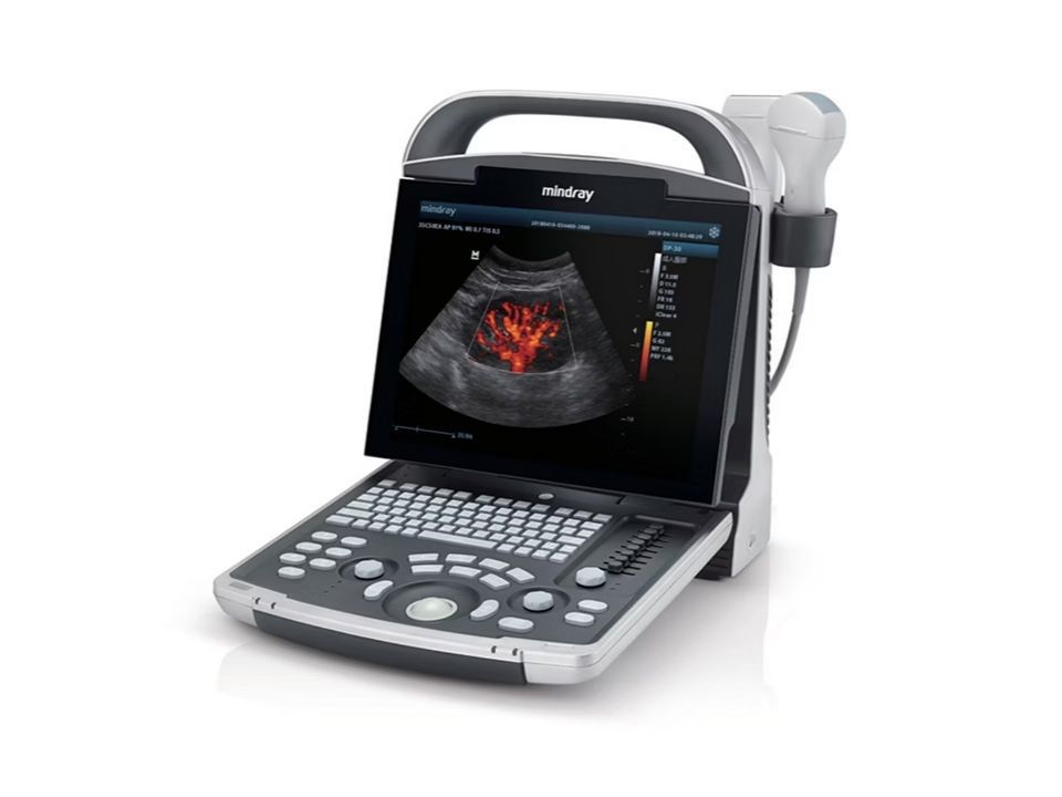 Find the Ultrasound Technology for Your Needs