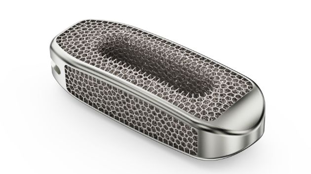 胸腰椎融合器O型-B