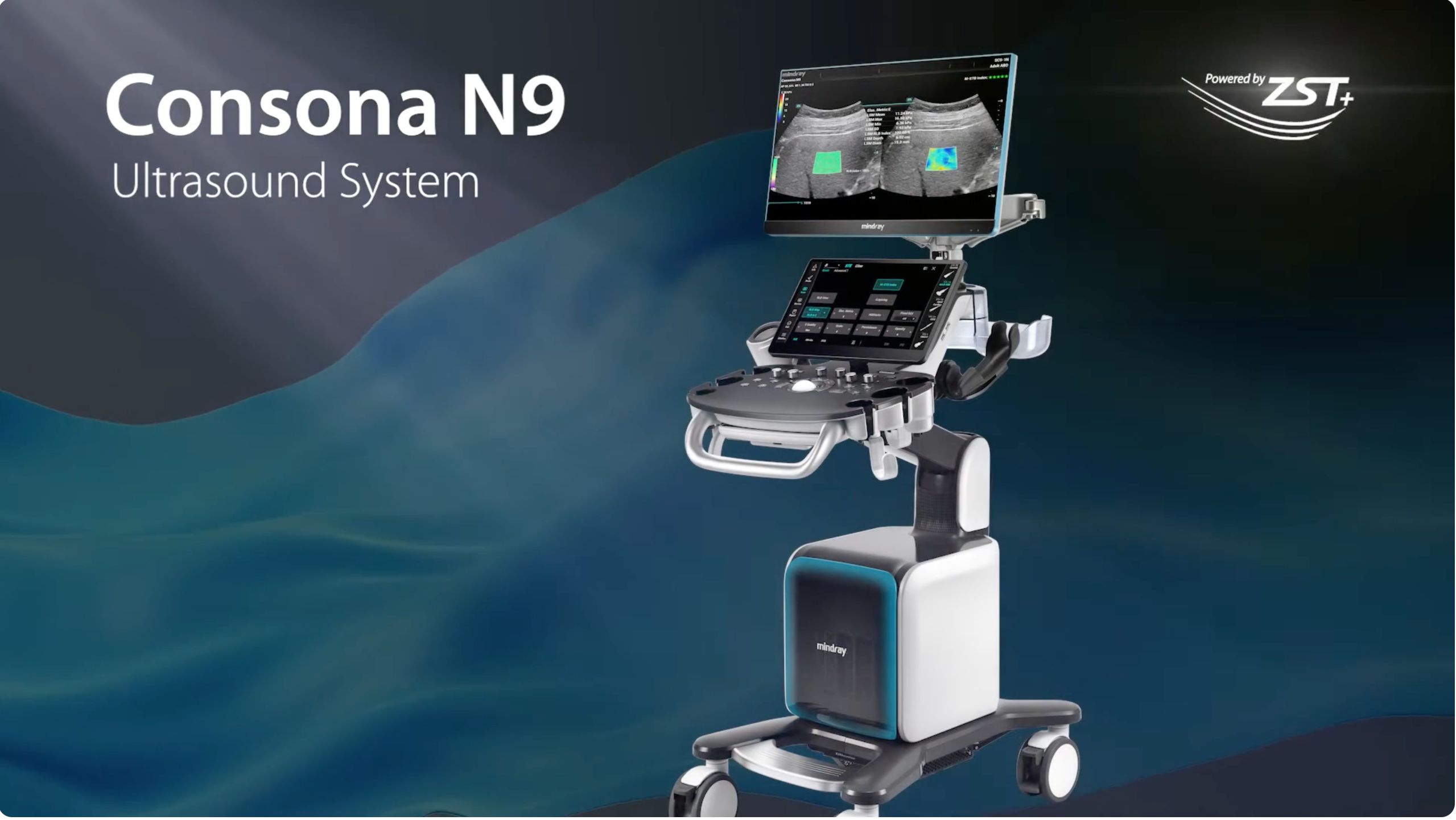 Consona N9 Banner PR 