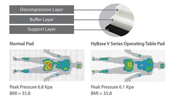 HyBase_V6_surgical_decompression-layer
