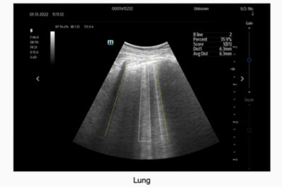 TE7 Max Portable Ultrasound by Mindray