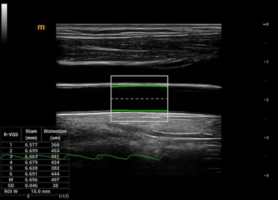 Recho R9 Vascular Function Assessment - R-VQS image
