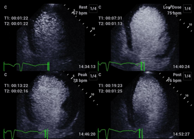 Recho R9 Stress Echo image
