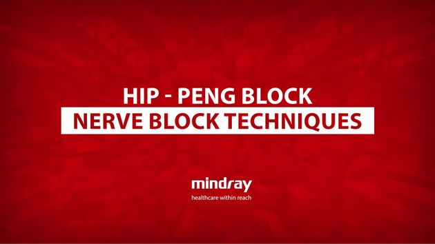 Product Tab B Component 630x354 - 1