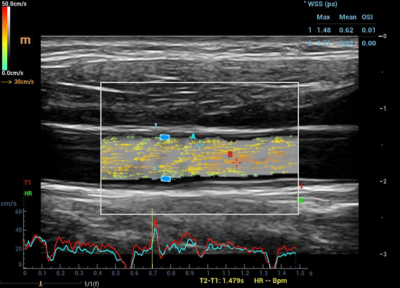Recho R9 Vascular Function Assessment - V Flow image