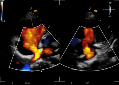 Recho R9 Real-time 3D Cardiac lmaging - X-Vue Image