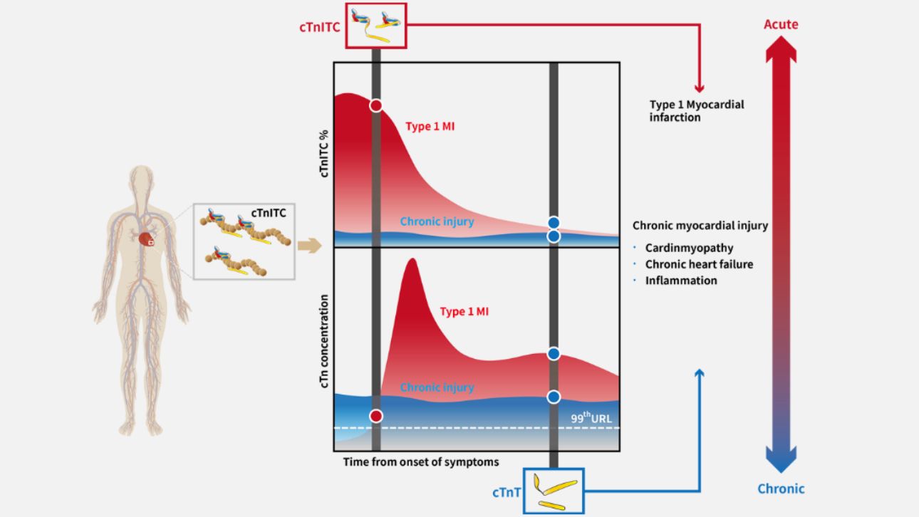 cTn concentration and cTnITC % in Chronic injury over time from onset of symptoms