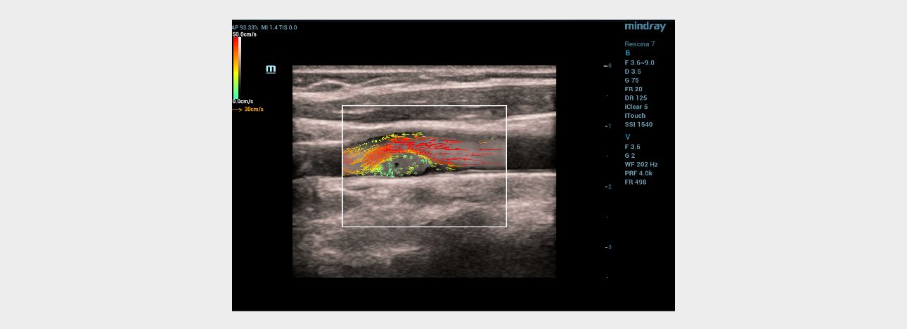 aotid-web-v-flow-fig4-pc