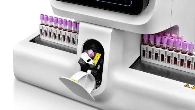 BC-7600 Series Auto Hematology Analyzers - automation ESR test results