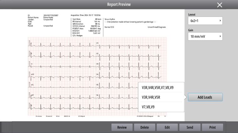 BeneHeart R700/R900 Electrocardiograph - Visual Electrode Status Indicator