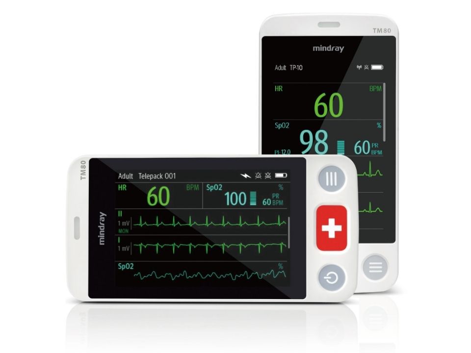 Benevision TM80