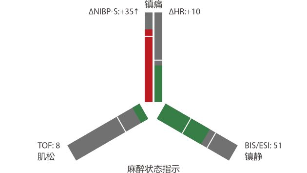 BeneVision™ VMAX/V700/V500/V200 OR病人监护仪 - 智能辅助工具BoA Dashboard™