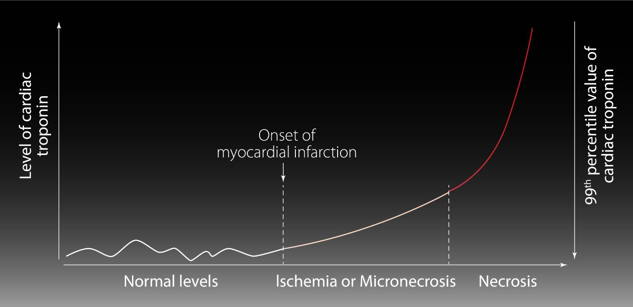 hs-cTnl: Empowering Heart Risk Assessment