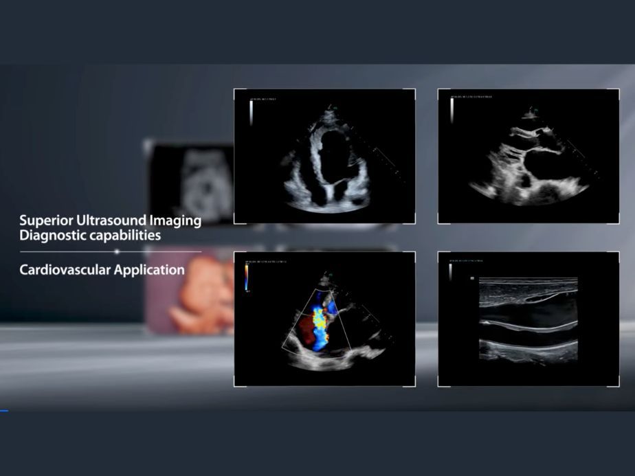 Cardio Application From video