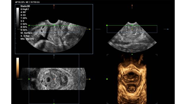 Consona Series Women Health Solution - Smart Pelvic feature image