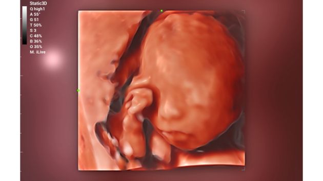 Consona Series Women Health Solution - iLive feature image