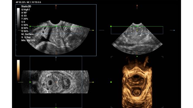 Consona Series Women Health Solution - Smart Plane CNS feature image