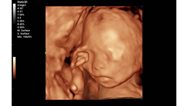 Consona Series Women Health Solution - Smart Face feature image