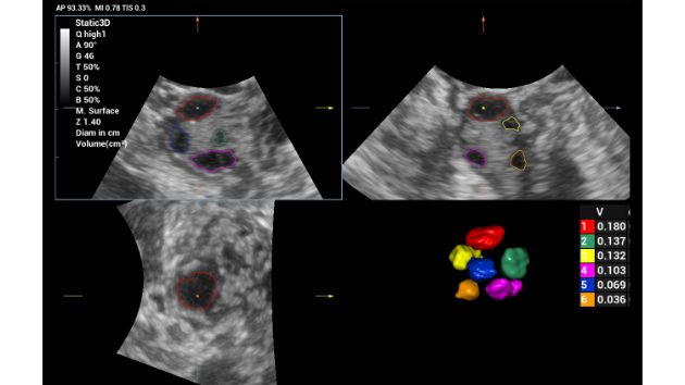 Consona Series Women Health Solution - Smart FLC feature image