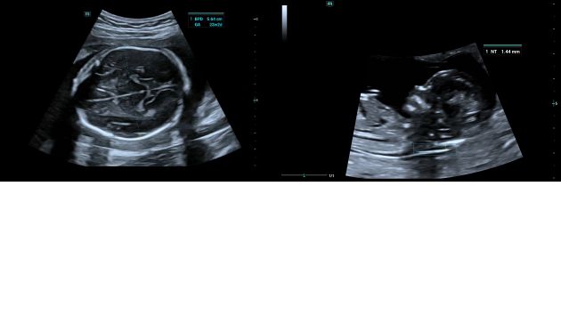 Consona Series Women Health Solution - Smart OB/NT feature image