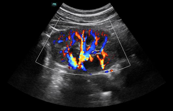 consona-n5-clinical-image-renal-cdi-1.0-en