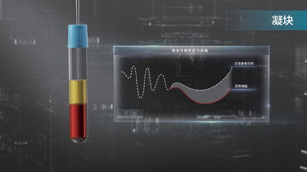 CX-6000 - 凝块样本曲线核查