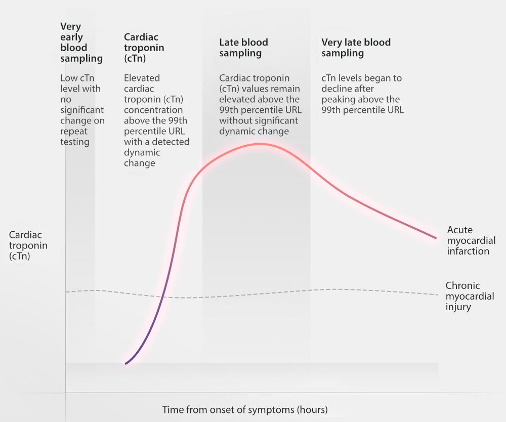diagram of Time from onset of symptoms for Cardiac troponin
