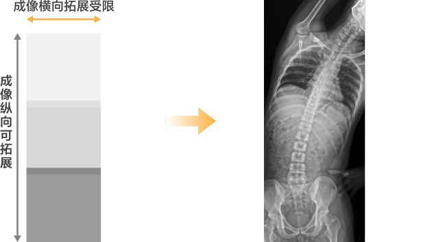 凌云 DigiEye U 系列数字化摄影X射线系统 - 传统拼接成像示意