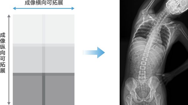 凌云 DigiEye U 系列数字化摄影X射线系统 - 宽场成像示意