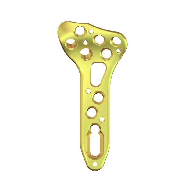 Locking Plate - Radius