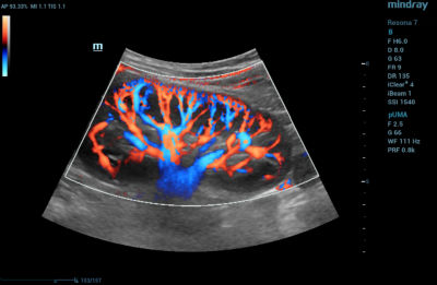 Doppler Ultrasound: Many Shades of Color