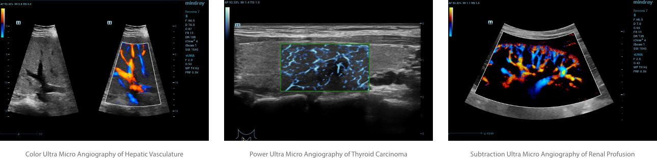 doppler-shades-color-fig21-pc