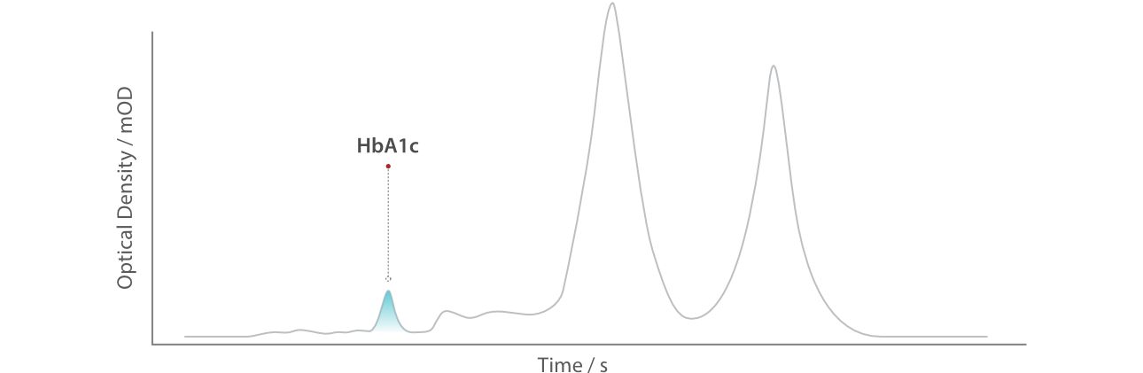 HPLC chromatogram of glycated hemoglobin