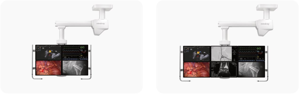 Imaging Mounting Solution