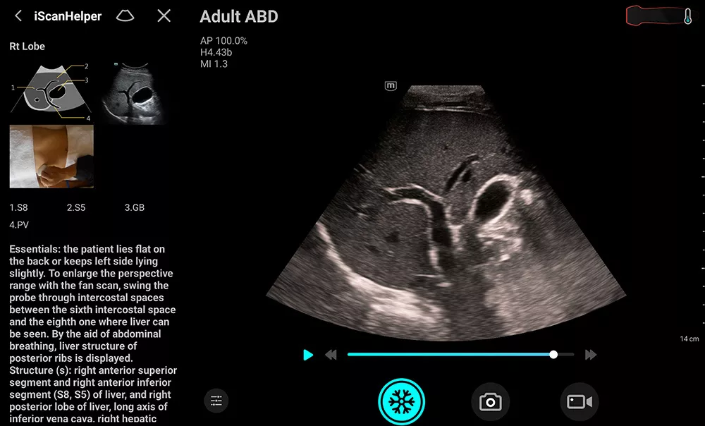 Image clinique TE Air e5M - iScanHelper pour ABD