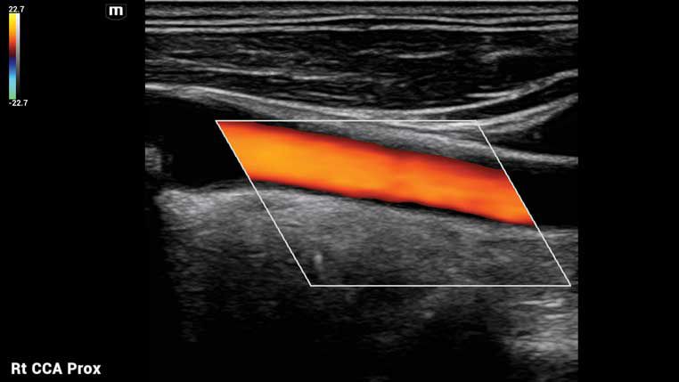 iWorks_762x429_PC_HD