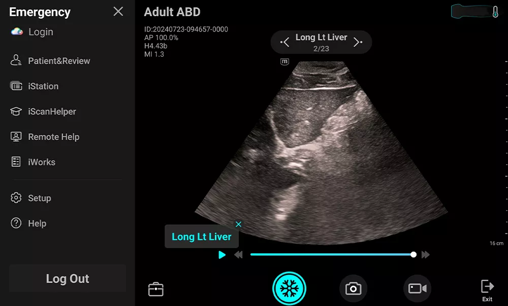 Image clinique TE Air e5M - iWork pour ABD