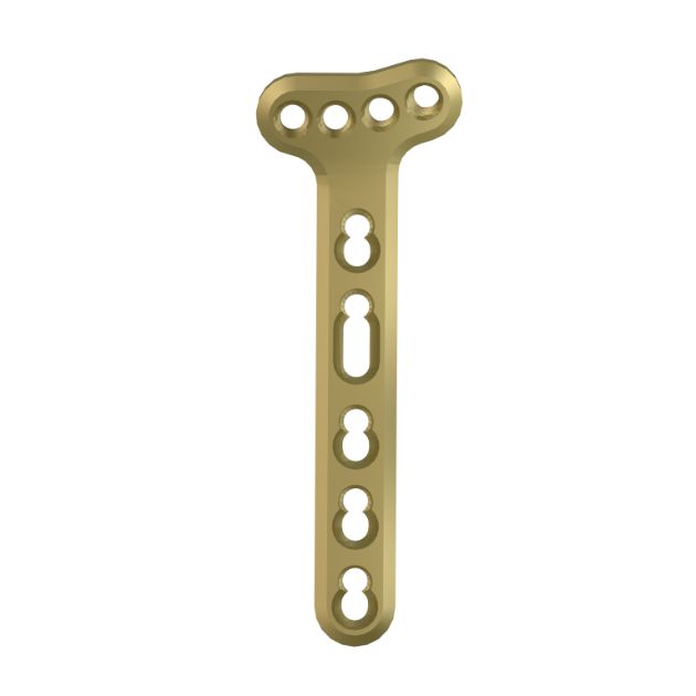 Locking Plate - Radius