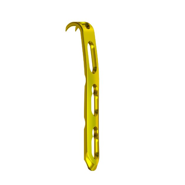 Locking Plate - Ulna