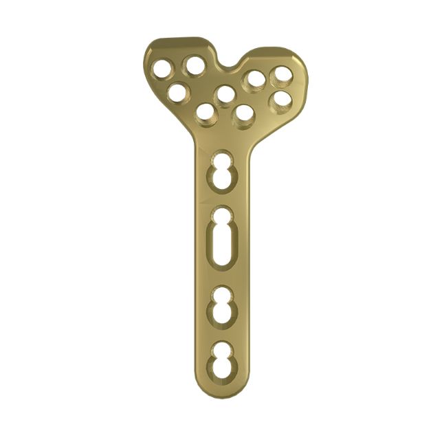 Locking Plate - Radius