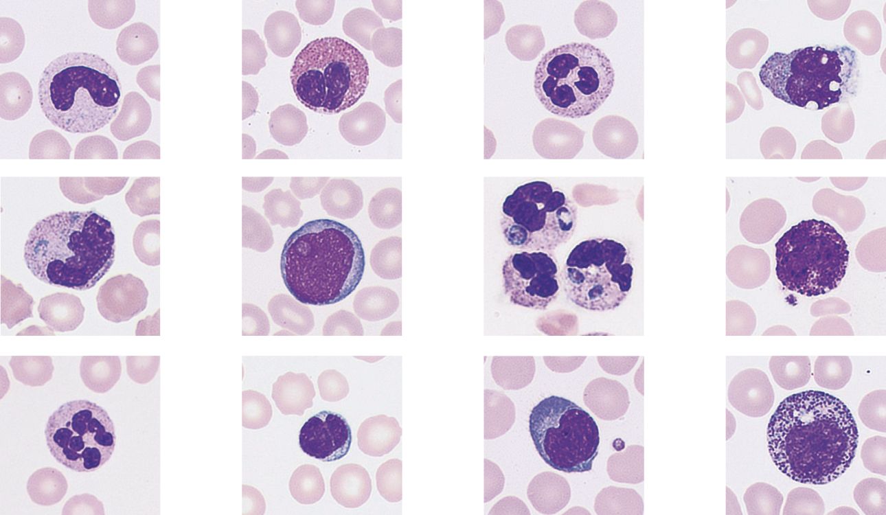 Display the ultra clarity and authenticity of each cell - Peripheral Blood